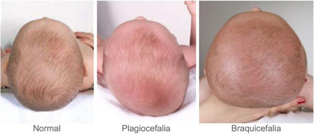 81189-COJIN JANE PLAGIOCEFALIA(13-3)-2